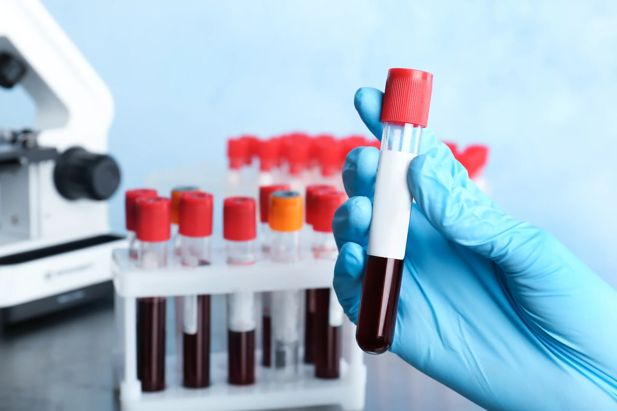 Muestra de sangre y equipo de laboratorio para análisis clínicos